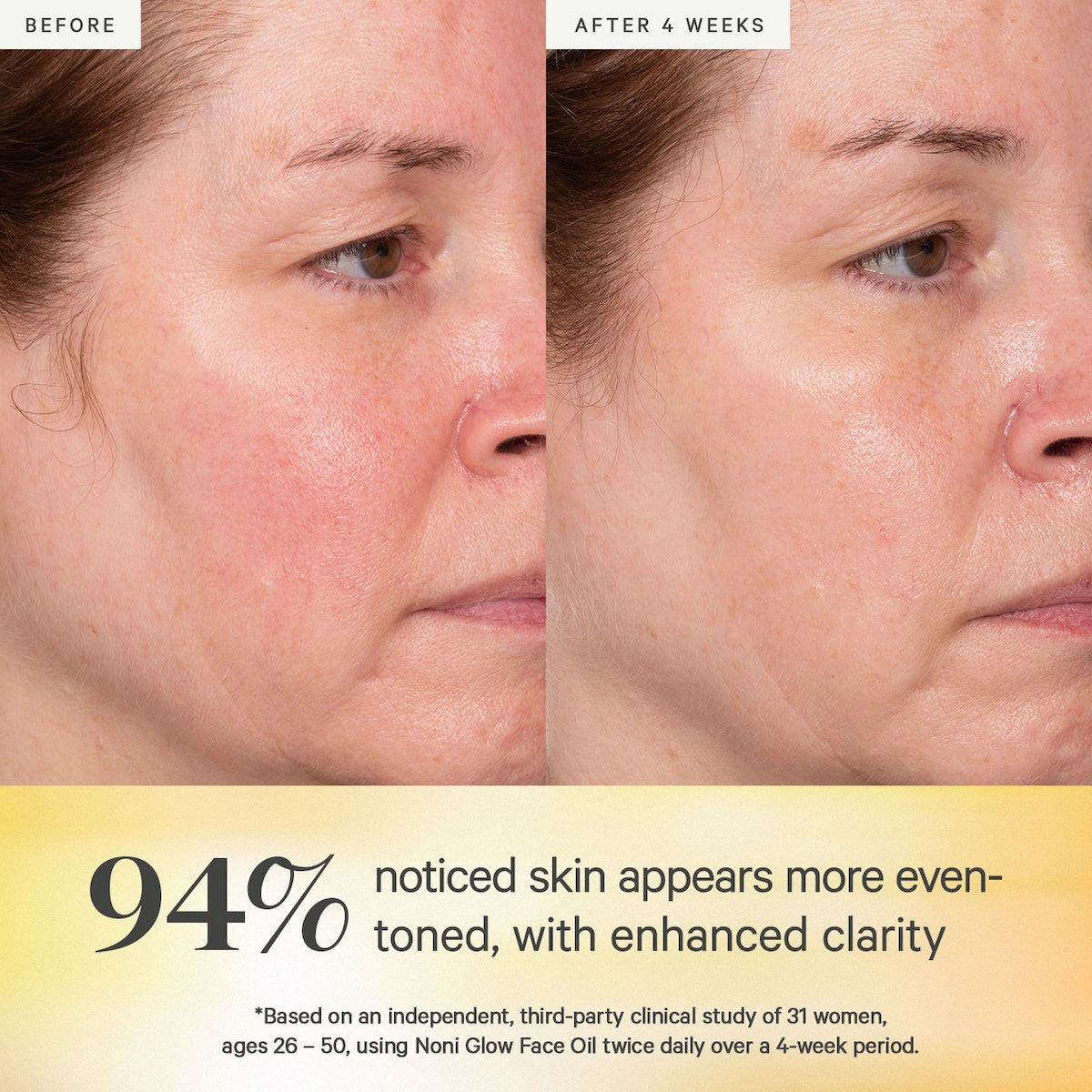 Noni Glow Face Oil 5